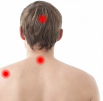 Focos de osteocondrose