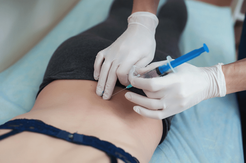 bloqueo na osteocondrose lumbar